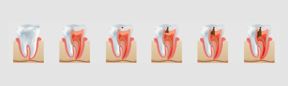 Odontotología conservadora y general