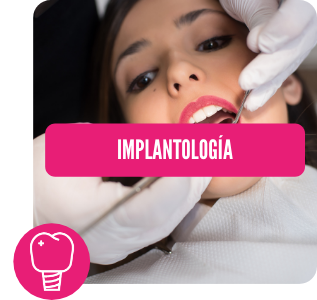 Tratamientos dentista en Córdoba