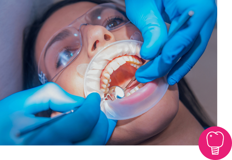 implantes dentales en Cordoba